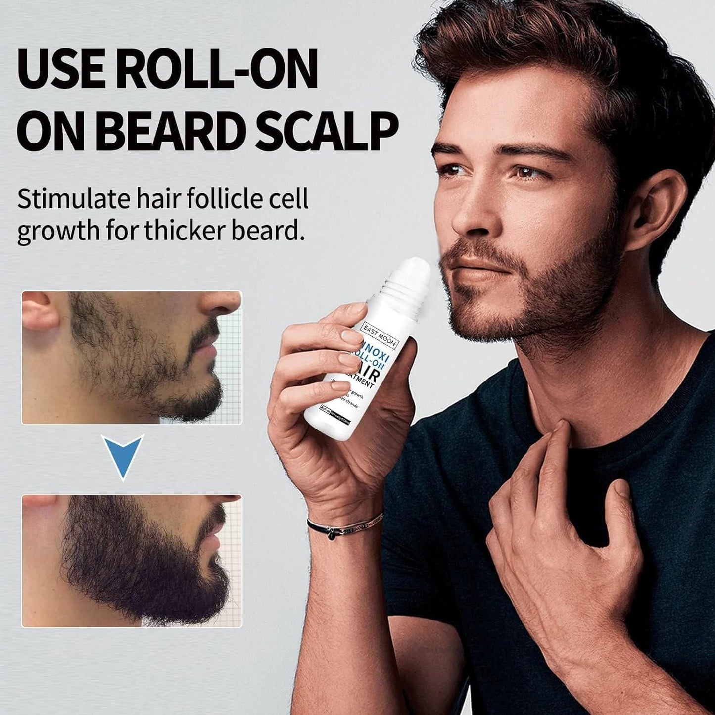 Minoxi Roll-On Hair Treatment (Pack of 2)